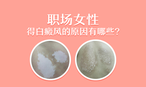 手上白癜风症状