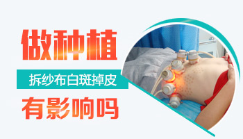 保定看白癜风治疗白癜风医院排名
