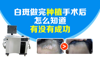 白癜风早期症状图
