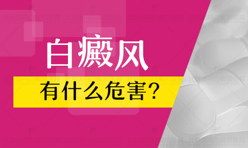 伍德灯下一块块白代表是白癜风吗