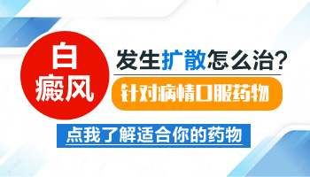 伍德灯检查一大块白色说是白癜风靠谱吗