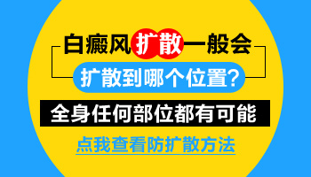 小孩脸上有白斑