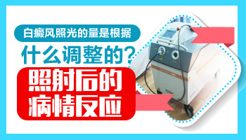 人的手部为什么会得白癜风