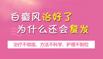 白癜风常见病因有几点