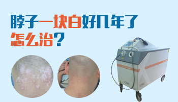 白癜风一般都是什么原因引起的