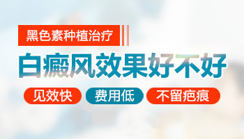 鸡蛋大面积白癜风打308光要几天可以停止照光