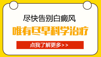 白癜风早期症状图