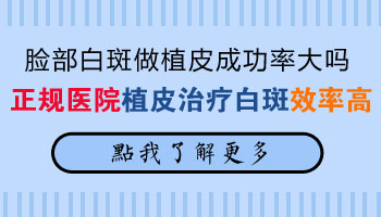 白癜风患者应该多吃什么