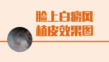 腿上有白斑