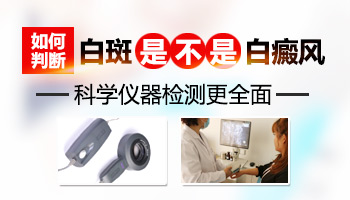 白癜风早期症状图