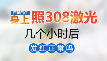 石家庄额头有白癜风治疗效果好的医院是哪个