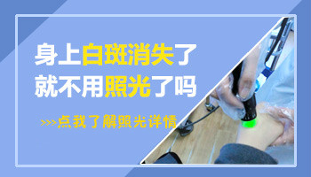 黑色素种植治疗白癜风怎么样