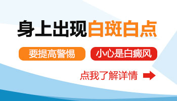 衡水治疗白癜风技术比较好的医院是哪家