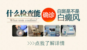 伍德灯检查早期白癜风