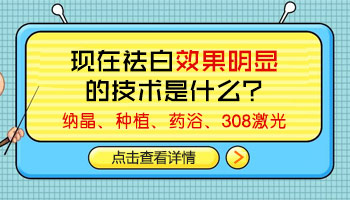 白癜风症状