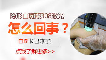 治疗白癜风好的医院
