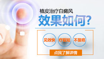 白癜风早期症状图