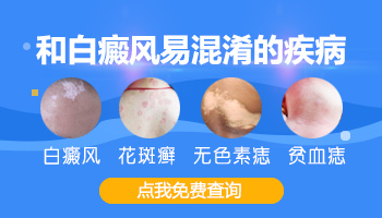 白癜风治疗三步走你才会好得快