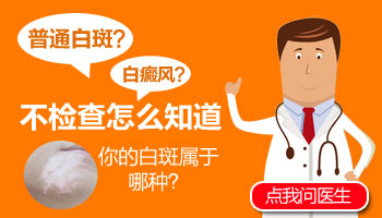 导致白斑的直接因素有什么