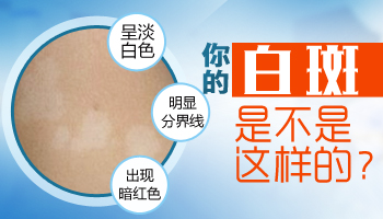 白癜风治疗总是不见好转为什么