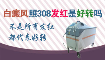 白斑病症状有哪些