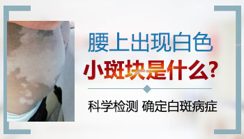 发现白斑你要这样做