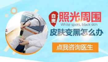 石家庄治疗儿童的白癜风要去哪里好