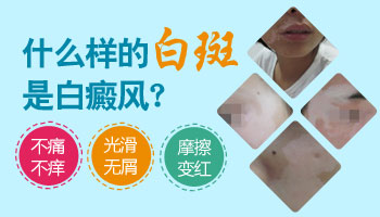 石家庄看白癜风的医院