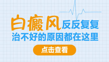 中医怎么治疗白斑--好不好