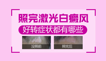 白癜风需要避免阳光的照射吗