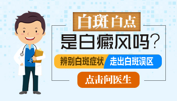 石家庄白癜风哪里治的好