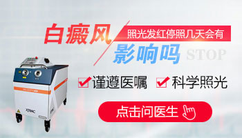 石家庄白癜风医院 如何应对春季白癜风高发的问题