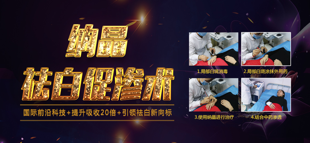 石家庄哪里可以治疗反复扩散的白斑