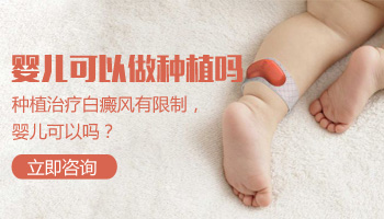 白癜风的危害有哪些