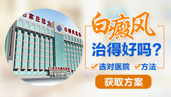白癜风的辅助治疗有哪些
