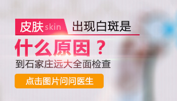 白斑病出现有什么症状特点