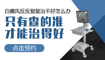 白斑病的常见病因有哪几种呢