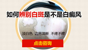 白斑病对不同人群有什么危害