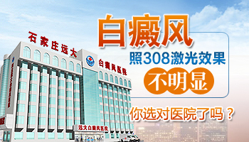 白斑病的主要诱发因素有哪些