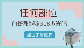 白癜风治疗