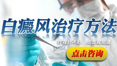 衡水哪些方式治疗白癜风会治疗