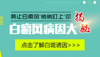 白癫风原因有哪些