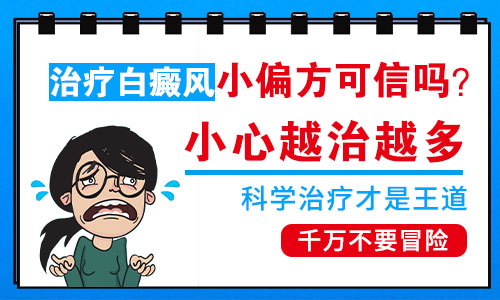 脸部白癜风可以用偏方治疗吗