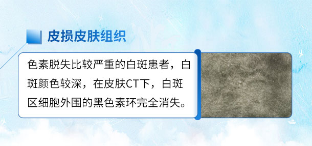 北京专家来啦!!特邀北京白癜风专家——苏有明教授将于4月5日来院会诊