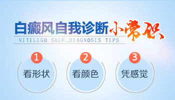 白癜风患者可以吃西瓜吗 白癜风的饮食