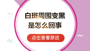 小孩有白癜风照射308激光照一次中间间隔几天