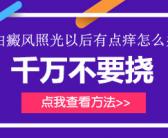 白癜风白斑在腿上适合什么方法效果才好