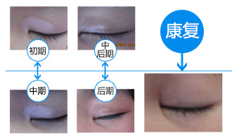 暑期白癜风专项普查计划开启