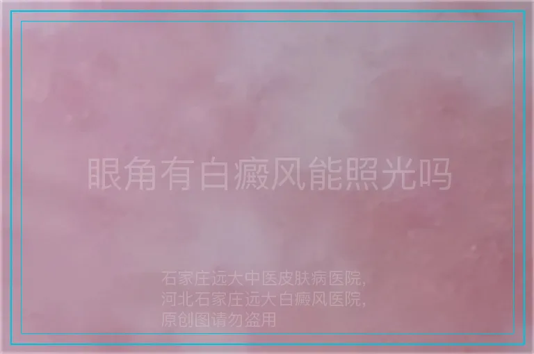 眼角有白癜风能照光吗