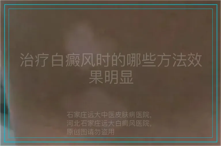 治疗白癜风时的哪些方法效果明显